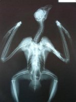 Radiografía ya recuperada