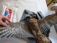 Deficit extensor inicial de carpo derecho 