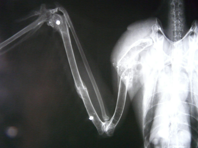 Radiografía del ala derecha donde se aprecian las fracturas y los perdigones