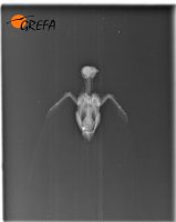 Radiografía para diagnosticar fractura de cúbito.