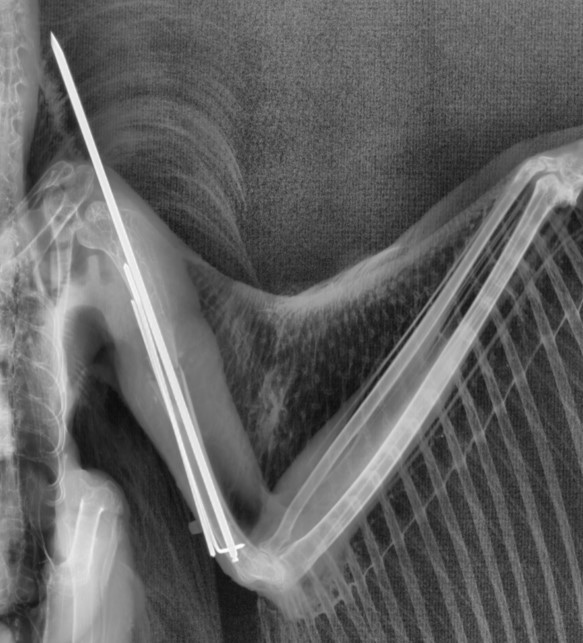 Radiografía en la que se aprecia el fijador externo y la aguja intramedular. 
