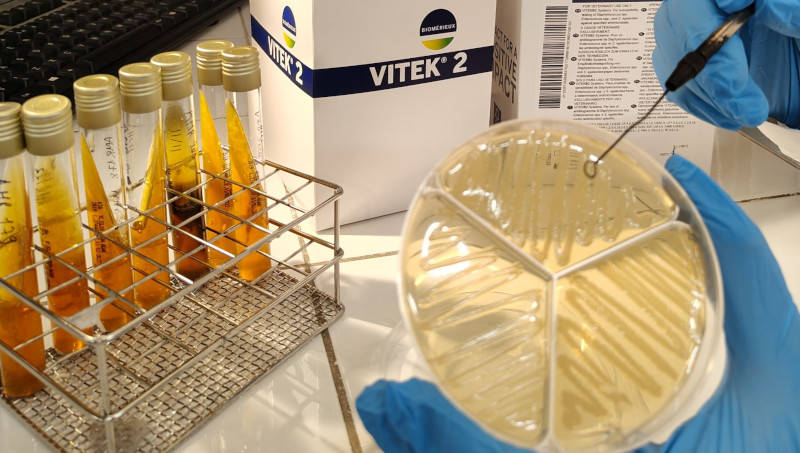 Análisis de resistencias antimicrobianas realizado con el VITEK® 2 COMPACT de bioMérieux.